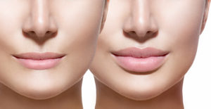 Lips side by side