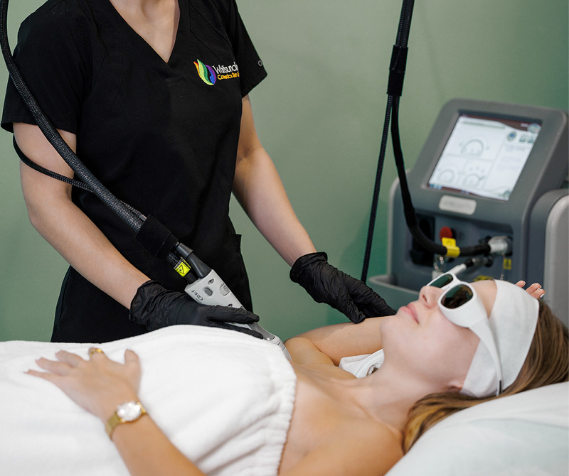 Candela laser hair removal