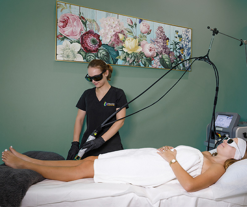 laser hair removal treatment